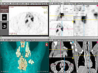 RadiAnt DICOM Viewer — przeglądarka kliniczna obrazów DICOM